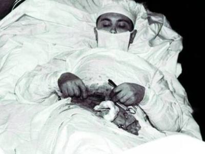 Il chirurgo che si operò da&nbsp;solo